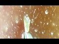 長い角栓!こんなに詰まってたの!?What a big it is!