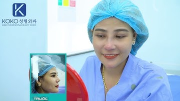 SỬA MŨI BỊ HỎNG tại Dr.Koko