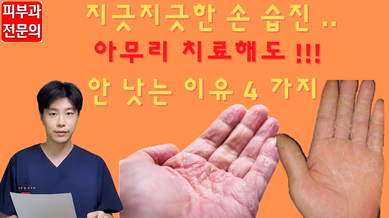 [손 습진] 생활 속 관리법 '4 가지' by 피부과 전문의
