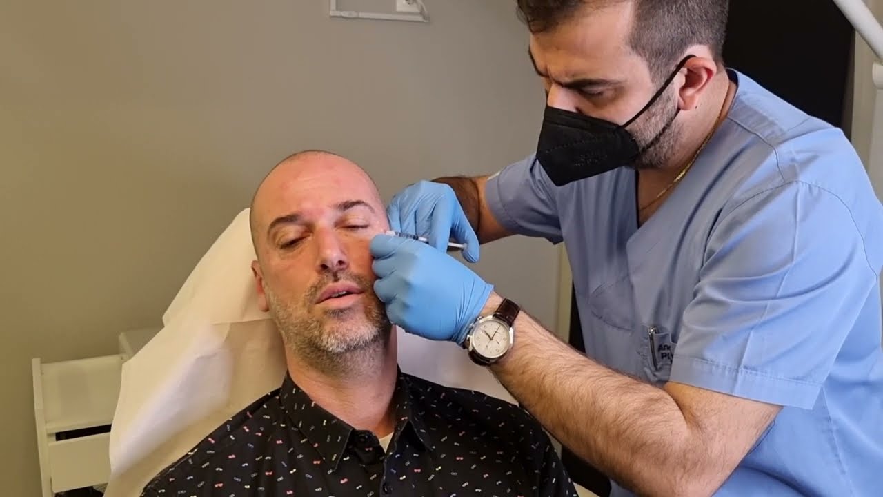 Botox (Μπότοξ) σε ανδρικό πρόσωπο: Εφαρμογή σε μέτωπο και μάτια