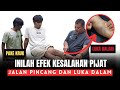 Inilah efek kesalahan pijat  jalan pincang menggunakan kruk dan luka dalam pada cedera lutut acl