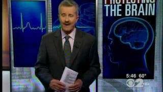 JFK Offers Innovative Induced Hypothermia Treatment for Stroke