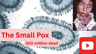 PART 1 The Speckled Monster: Humanity’s 3,000-Year War with Smallpox