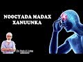 MADAXA MA KU XANUUNAA Noocyada Madax Xanuunka Iyo Sida Loo Daaweyo Dr Faris MADAXA MA KU XANUUNAA Noocyada Madax Xanuunka Iyo Sida Loo Daaweyo Dr Faris