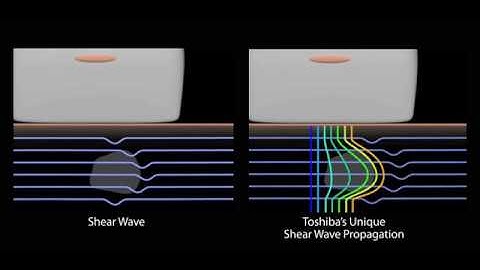 Shear Wave Elastography Suite