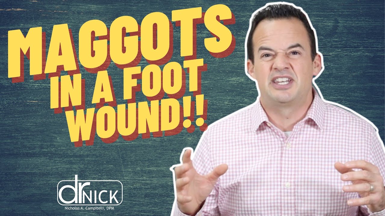 How Does a Wound Get Maggots?! Dr. Nick Campitelli YouTube
