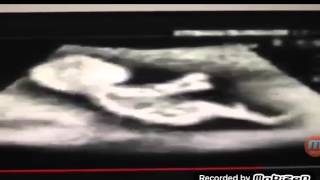 Annesinin Karnında Araba Süren Çocuk D