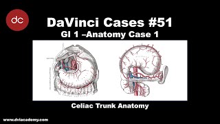 Celiac Trunk Anatomy Case [#DaVinciCases Gastrointestinal 1 - Anatomy Case 1]