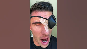 I LOST MY EYEBALLS 
