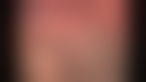 laparoscopic retroperitoneal pyelolithotomy