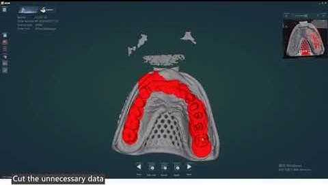 UP560 impression scanning