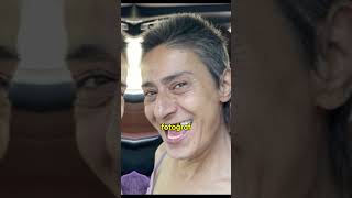 İmplant Tedavi̇si̇ Gören Yildiz Ti̇lbeni̇n Verdi̇ği̇ Poz, Sosyal Medyada Gündem Oldu.