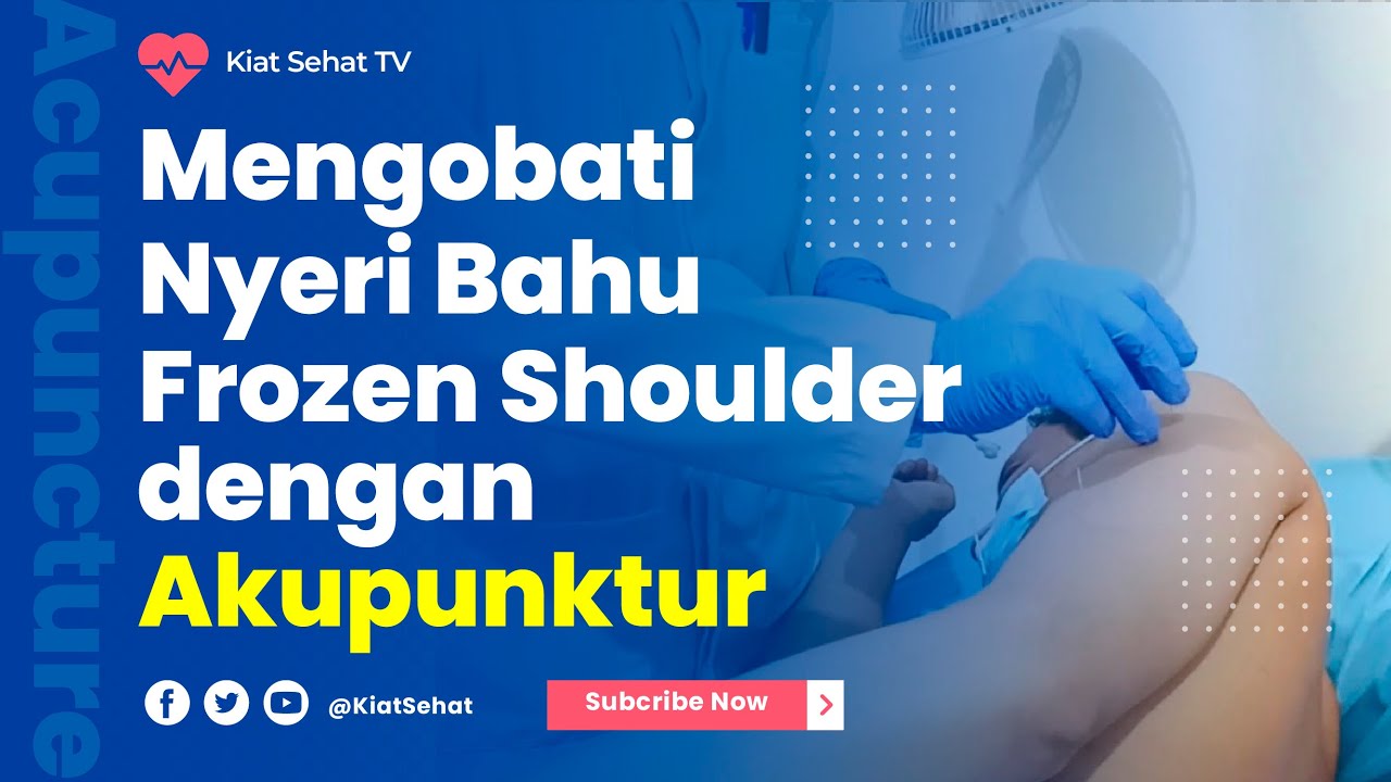 Mengobati Nyeri Bahu atau Frozen Shoulder dengan Akupunktur 