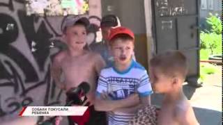 Во Владивостоке бродячие собаки покусали ребенка