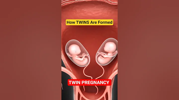 👶👶How Twins are Formed | Fraternal Twins Pregnancy 🤰#fertilization #anatomy #shorts