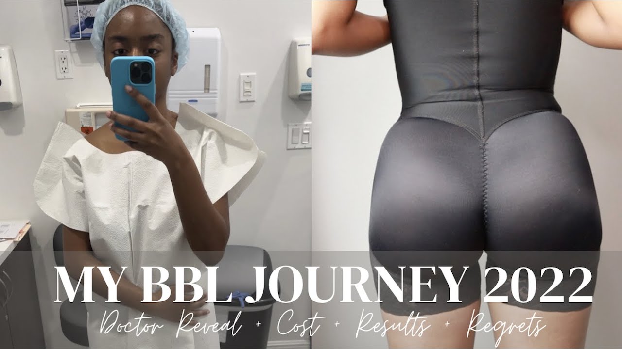 MY BBL JOURNEY 2022 Dr. William Miami + COST + RESULTS + REGRETS