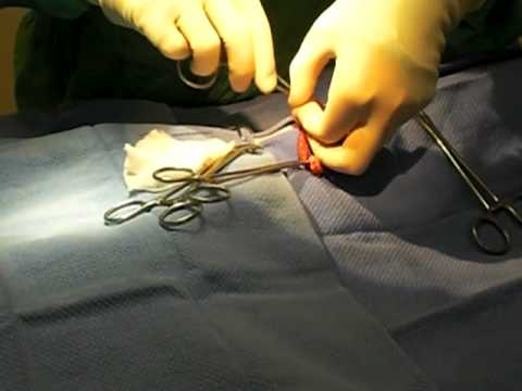 spaying a in heat midline cat spay doovi spaying a in heat midline cat spay doovi