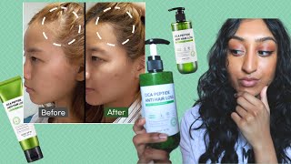 Stress Induced Hair Loss + Anti Hair Loss Products!