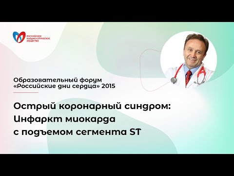 Острый коронарный синдром: Инфаркт миокарда с подъемом сегмента ST. Аверков О.В.