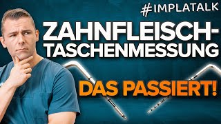 Psi-Index Und Parodontalstatus - So Läuft Es Ab Wann Liegt Eine Parodontose Vor?