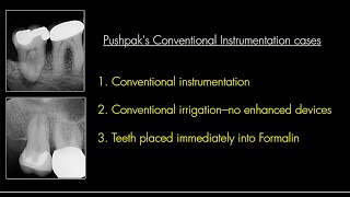 Full Introduction to Conventional Case irrigation study Guide