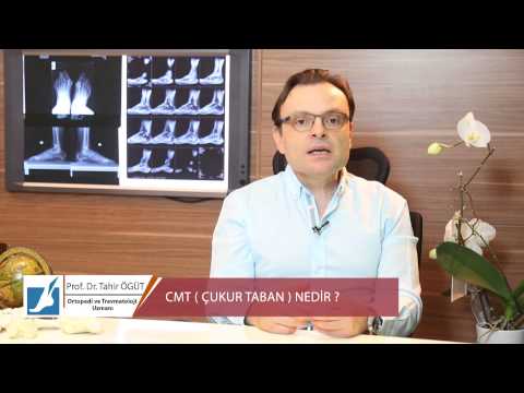 Prof. Dr. Tahir ÖĞÜT - CMT (ÇUKUR TABAN) NEDİR ?