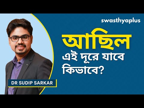 আছিল আসলে কি? | What is Skin Tag? in Bangla | Symptoms & Treatment | Dr Sudip Sarkar