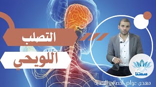 [Sclérose en plaque] أعراض التصلب اللويحي الحميد مع مهدي عواض