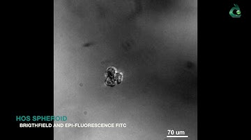 Osteosarcoma Cell Spheroid