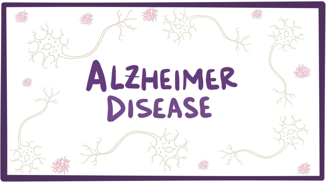Alzheimer S Chart
