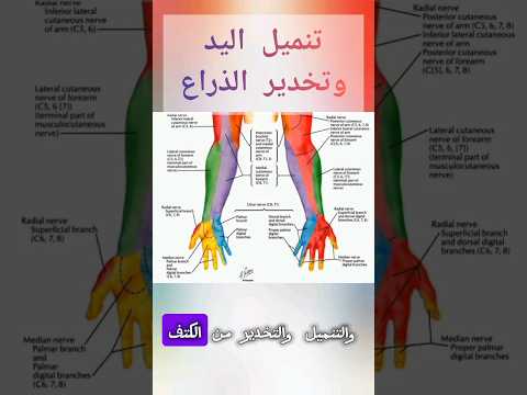 المرض العالمي تنميل اليد وتخدير الذراع