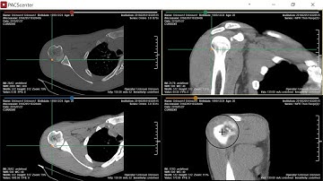 PACScenter - MPR   Pointer