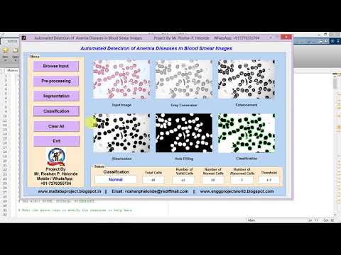 Anemia Detection using matlab