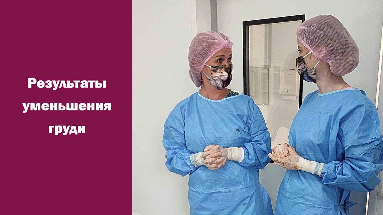Два результата уменьшения груди. Редукционная маммопластика с ...