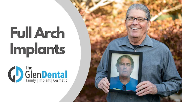 Dental Implants Gave Me An Instant Confidence Boost