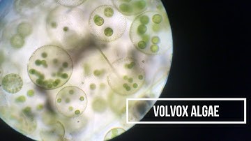 Microscope view: Volvox algae