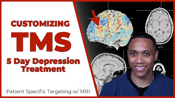 Treating Depression In 5 Days w/ Brain MRI | Accelerated TMS Targeting | Neopsych | Los Angeles