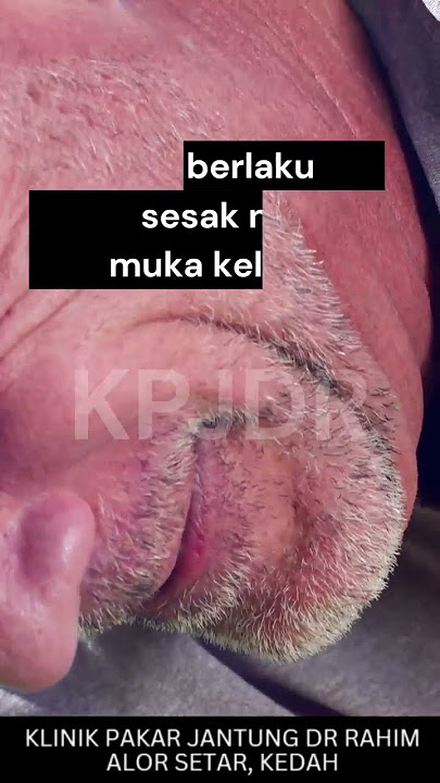 HAMPIR MATI KERANA MINYAK ANGIN