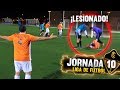 Lesionado partido liga jornada 10 crazy crew fc