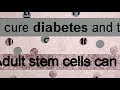 Diabetes and Stem Cells