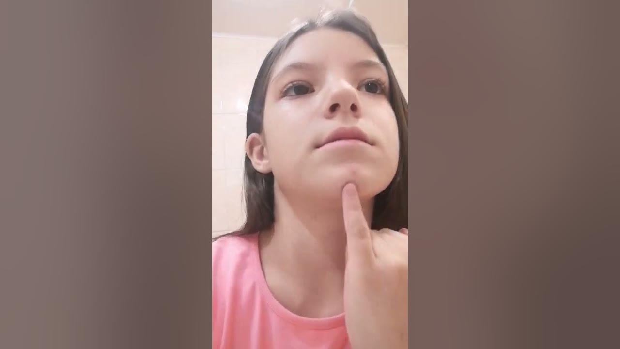 тот самый ПРЫШЬ - YouTube