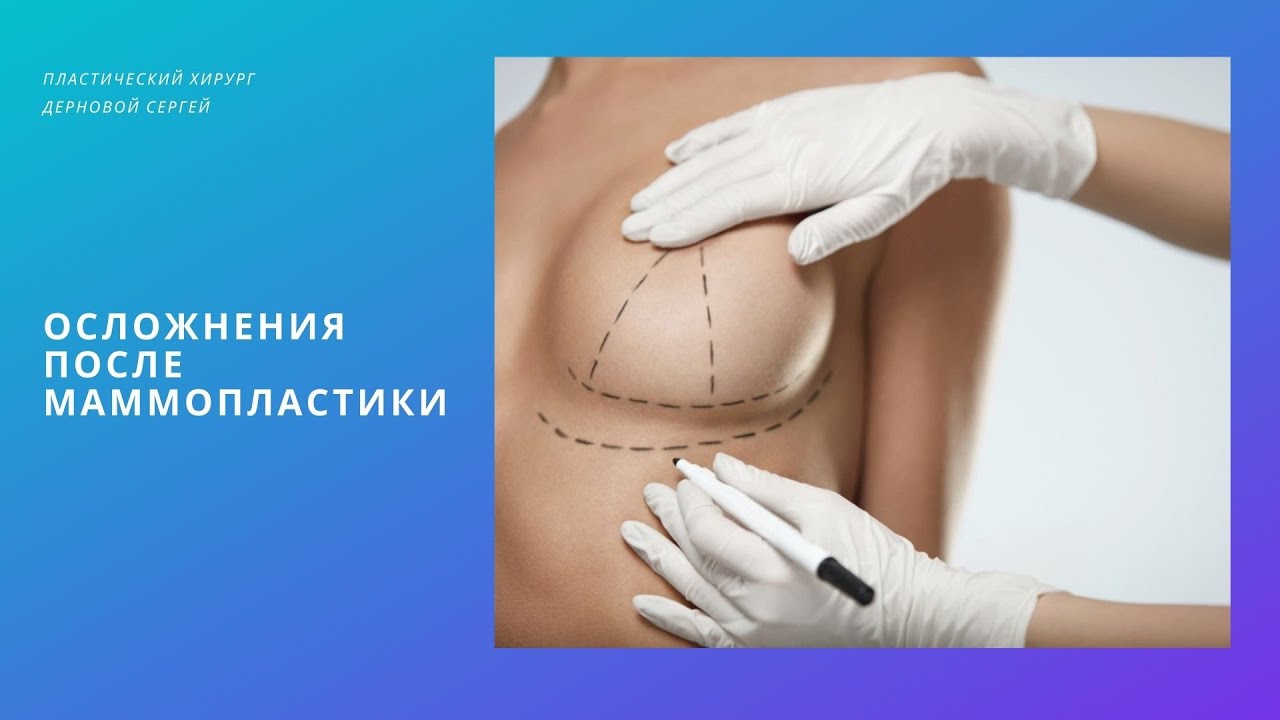 Осложнения после маммопластики