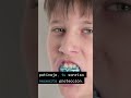 Protege tu sonrisa los mejores protectores bucales #smiledesigndental #dentist #dentistamiami
