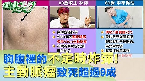 胸腹裡的不定時炸彈！ 主動脈瘤致死超過9成 健康2.0 - 天天要聞