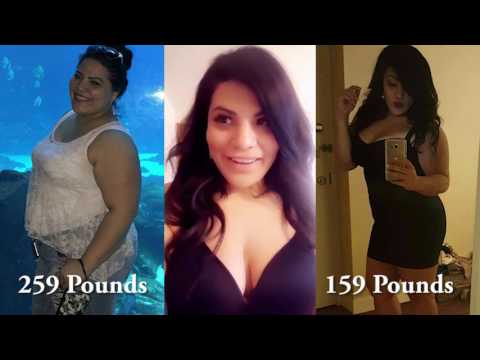 My Gastric Sleeve