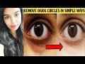 Remove dark circles permanently & naturally | undereye dark circles tamil