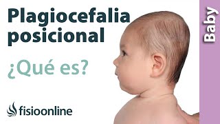 Qué es la Plagiocefalia? - Mega Baby