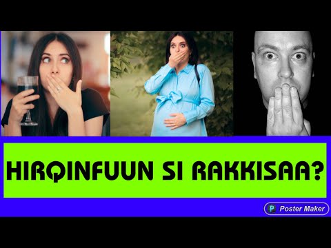 Hirqinfuun Dhukkubaa Si Rakkisaa The Cure For Hiccups That Works Every Single Time