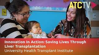 Innovation In Action: Saving Lives Through Liver Transplantation