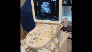 New arrival of Used Color Doppler Hitachi Avius ultrasound machines, Best price in Pakistan